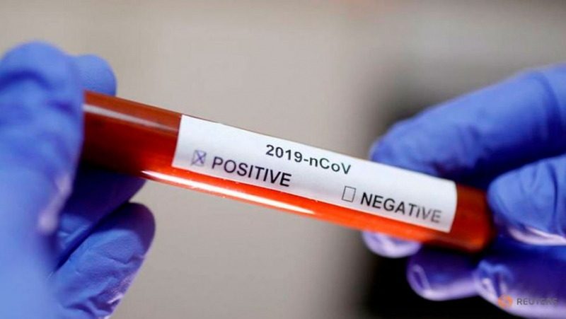 В США число зараженных коронавирусом превысило 2,5 тысячи