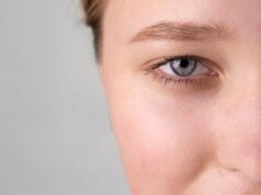 Как безопасно удалить папилломы на веках и в интимной зоне